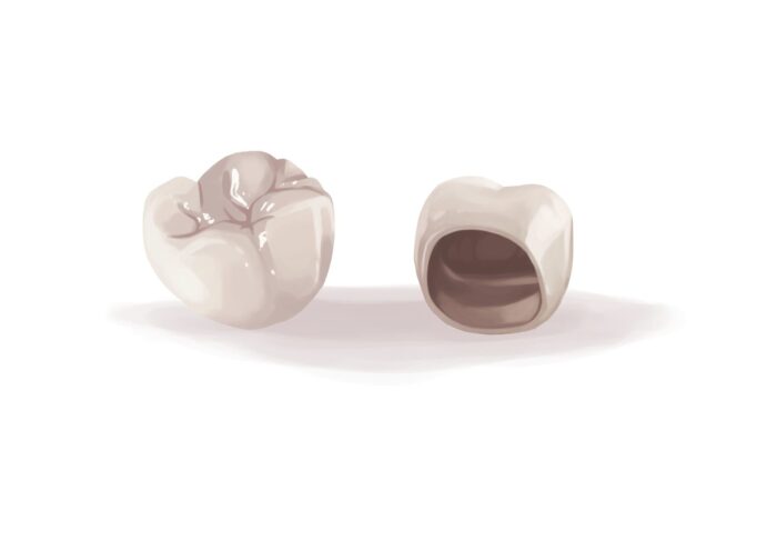 zirconia crown
