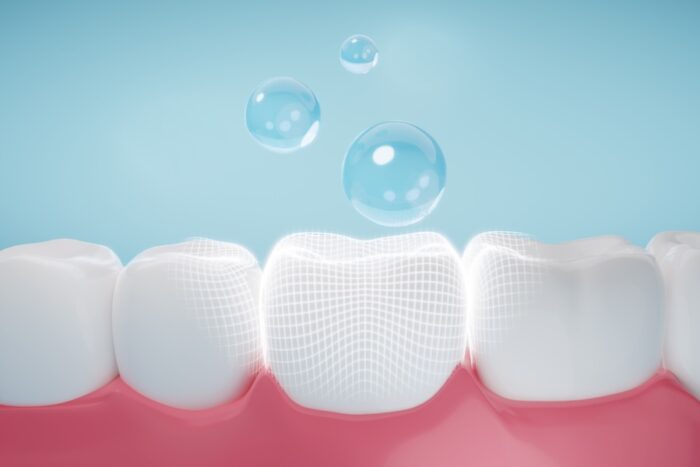 fluoride treatment on teeth